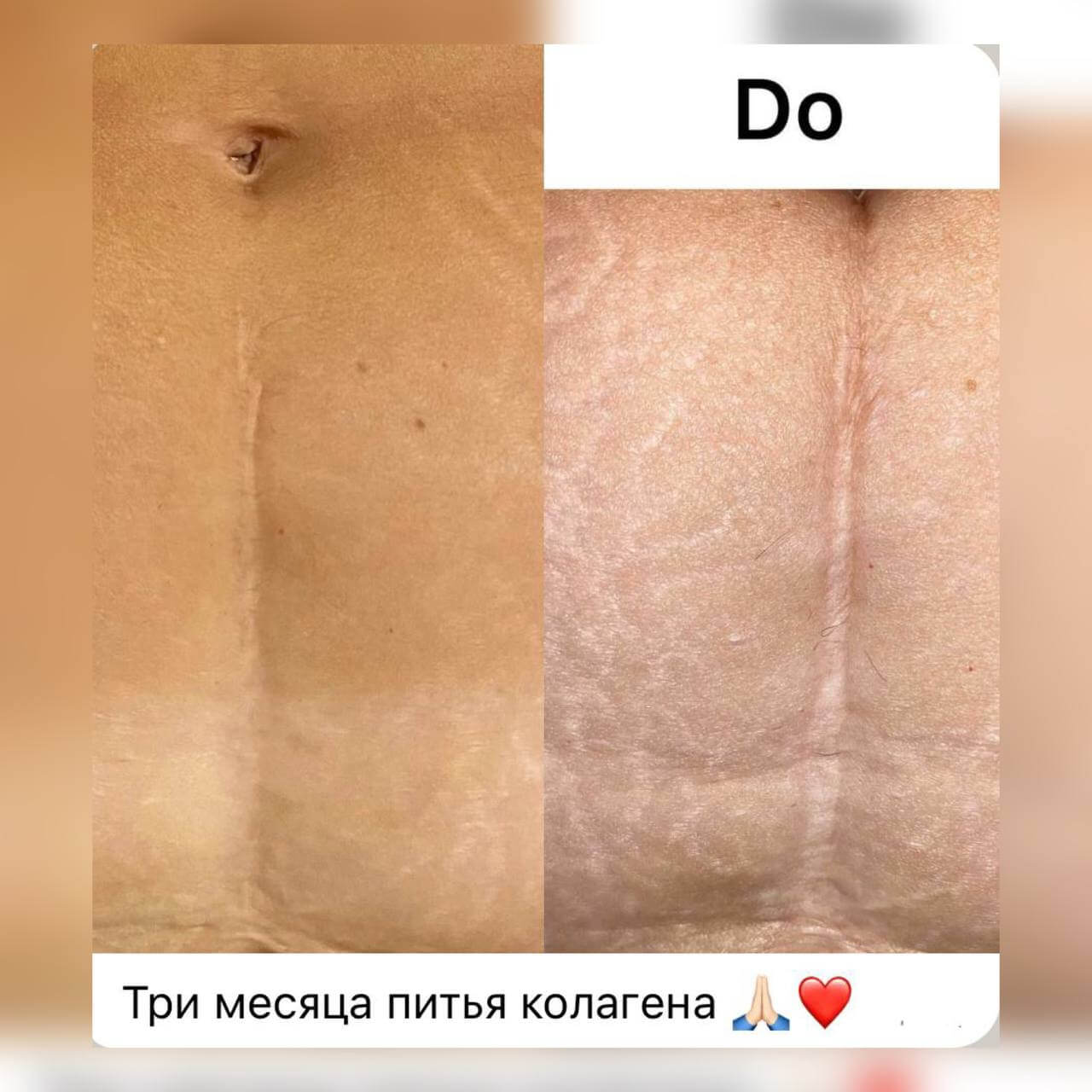 Корал Клаб Coral Club: дистрибьютор компании 7 Коллаген шрам отзывы Коралловый клуб