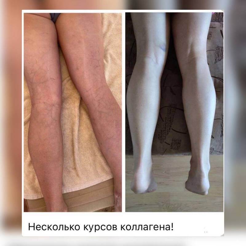 Корал Клаб Coral Club: дистрибьютор компании 14 Сосуды коллаген корал клаб