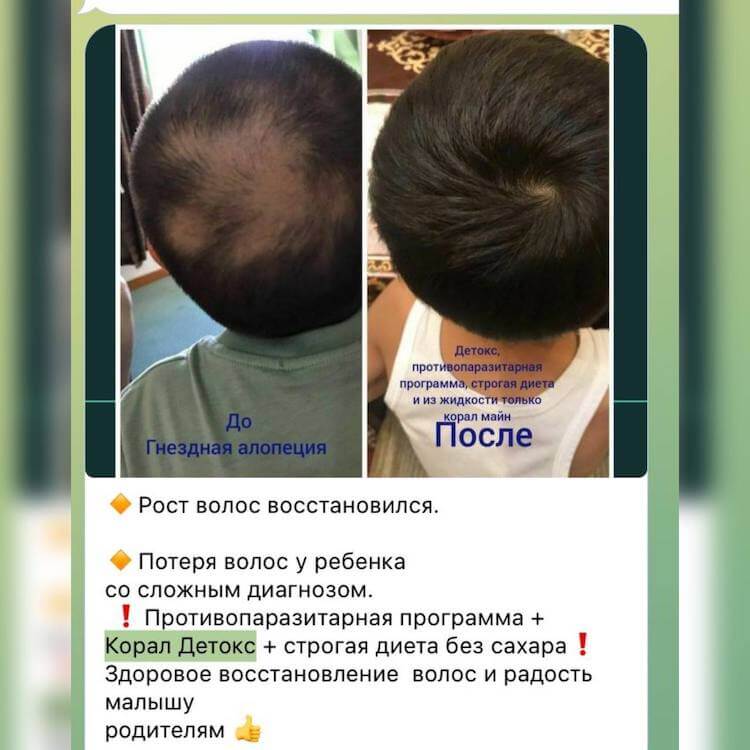 Корал Детокс отзывы 4