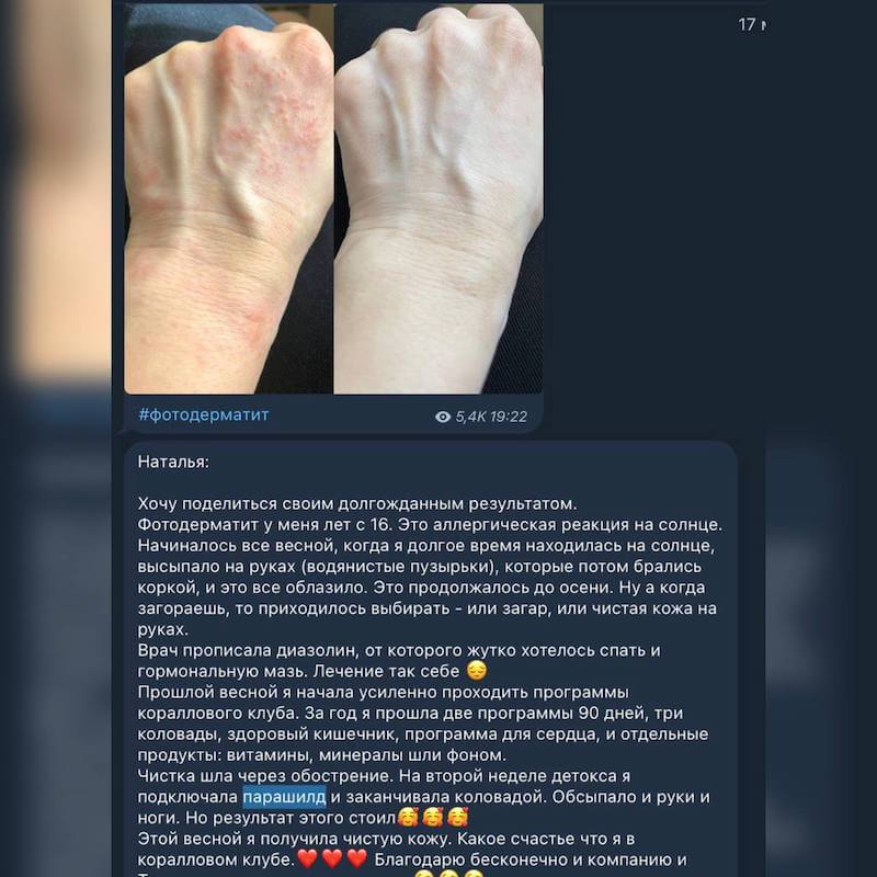 Парашилд отзывы 4