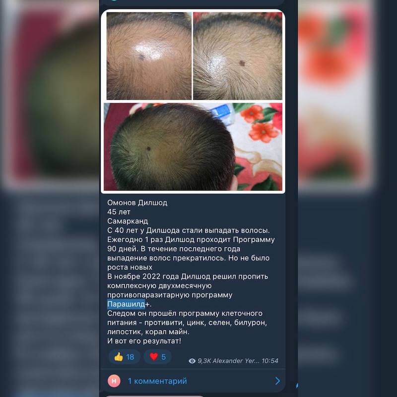 Парашилд отзывы 5