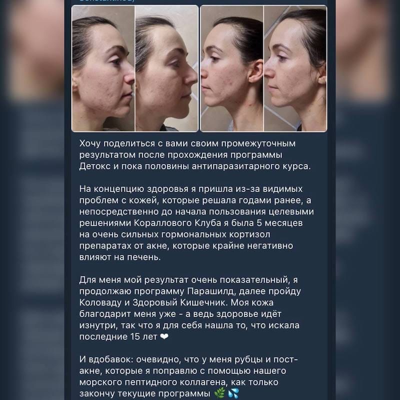 Парашилд отзывы 8